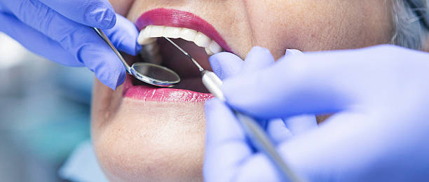 Best Emergency Dental Care for Sports Injuries in Perry, UT